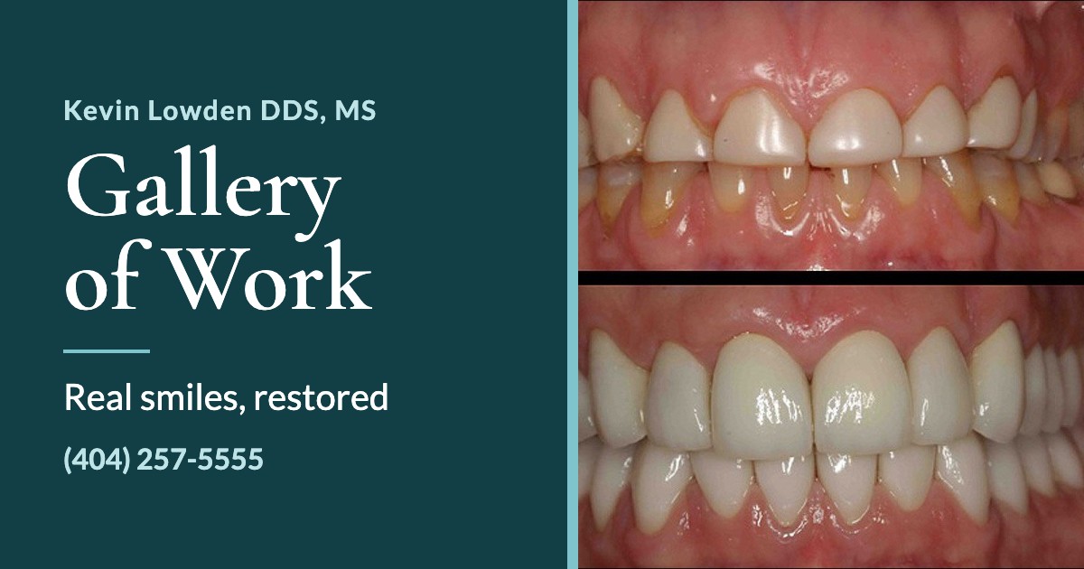 Link preview card for the Gallery of Work, with a restored smile